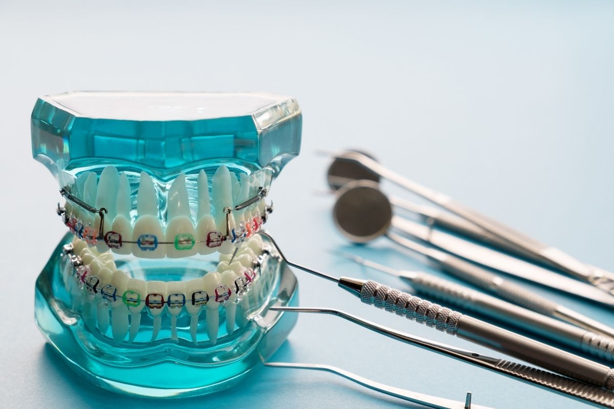 Esenyurt Ortodonti Tedavisi