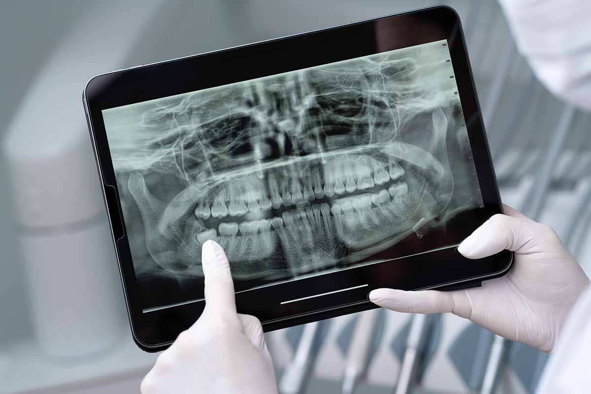 3D Tomografi Cihazı-4