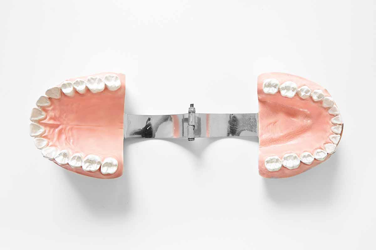 implant-ustu-protezler-5