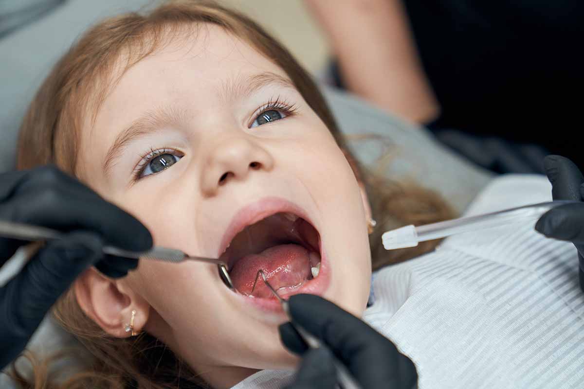 süt-disi-dolgulari-2