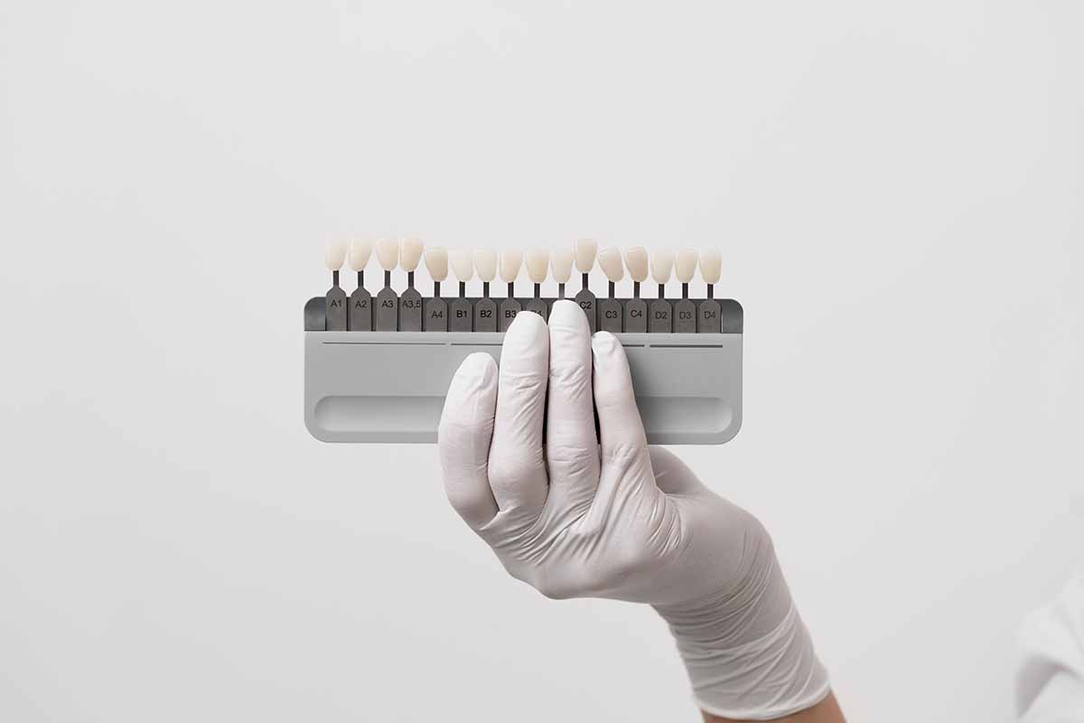 e-max-laminate-veneer-in-turkey