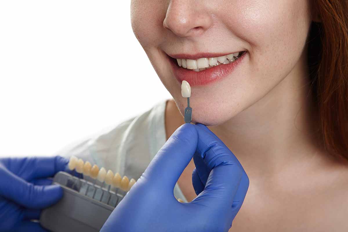 e-max-laminate-veneer-in-turkey