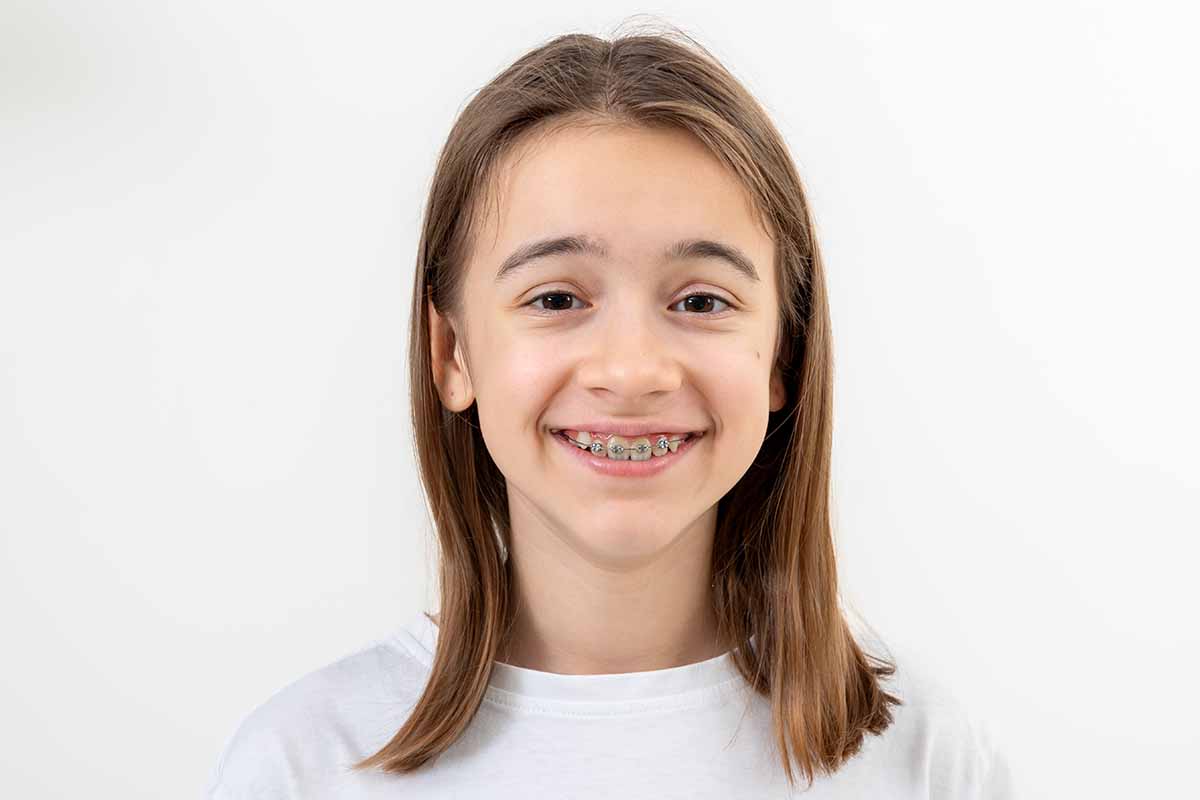 lingual-braces-in-turkey