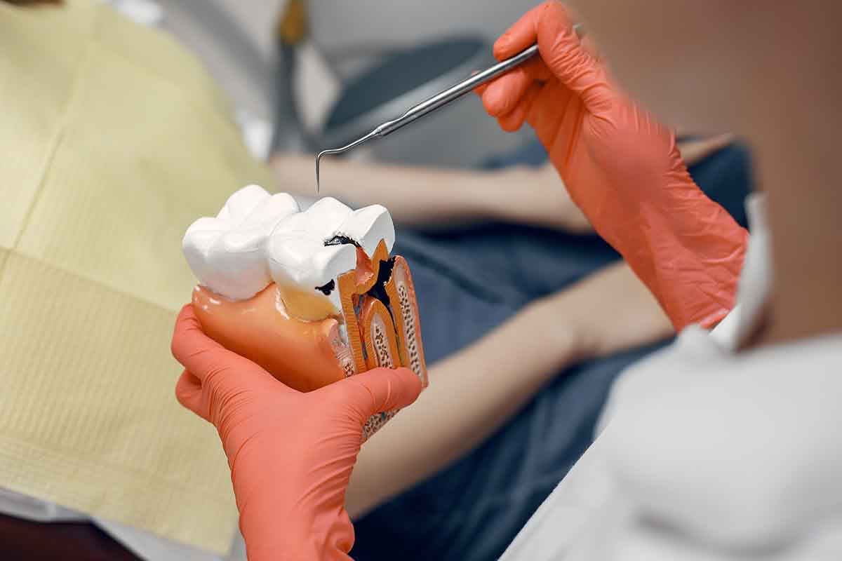 Wisdom Tooth Extraction in Turkey