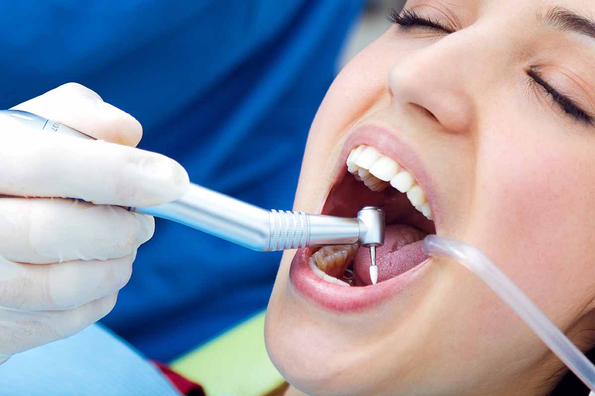 Dental Scaling and Teeth Cleaning in Turkey
