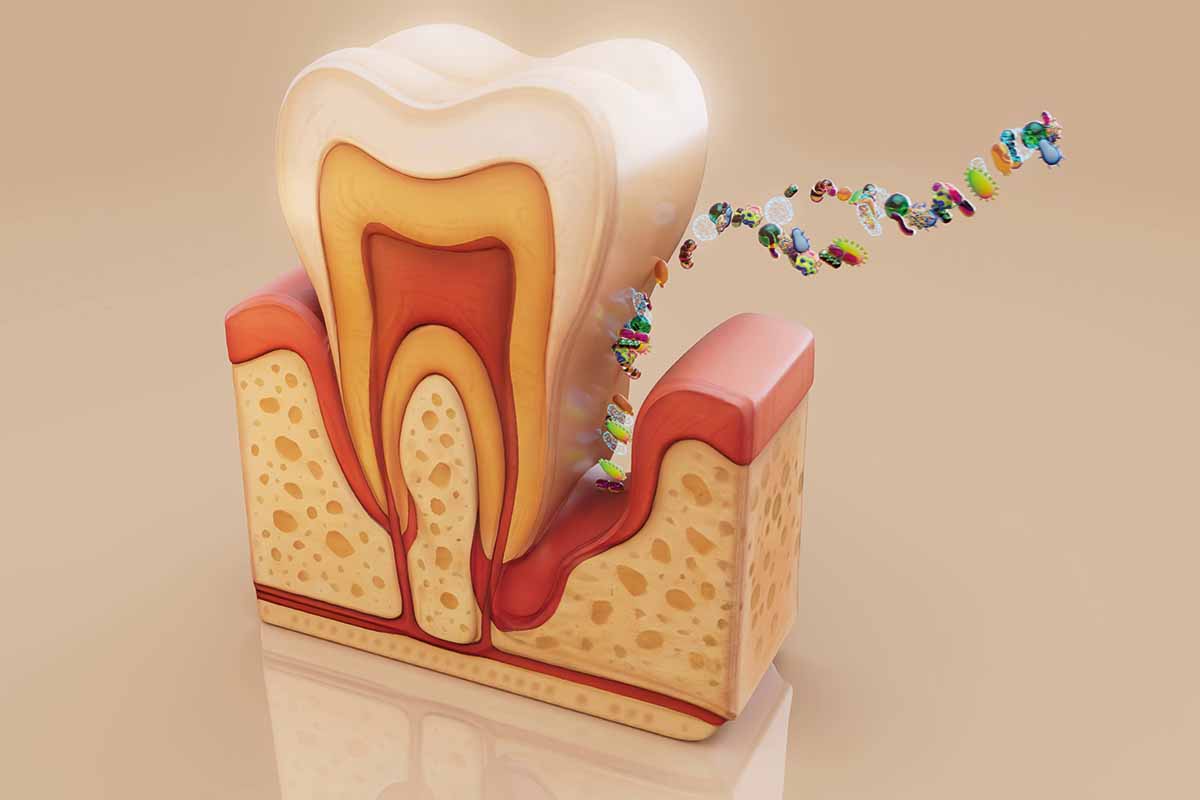 Periodontal Surgery in Turkey