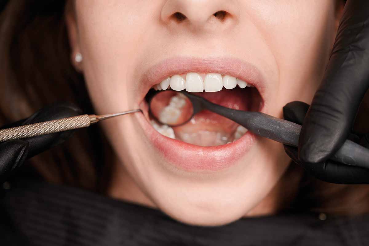 Periodontal Surgery in Turkey