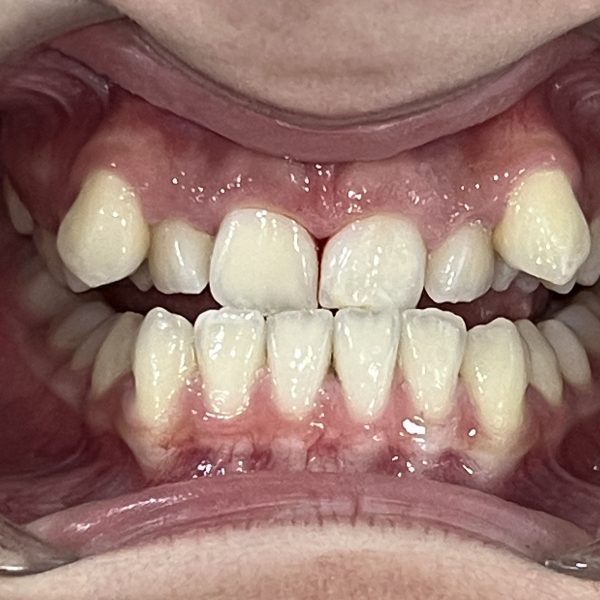 22408075_Berra_Senses_8_Anterior